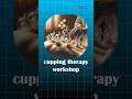 🔥✨ Master the Art of Cupping Therapy in Just 3 Days!