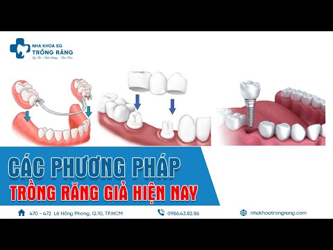 Video: Các loại răng cửa chính, phân loại và mục đích