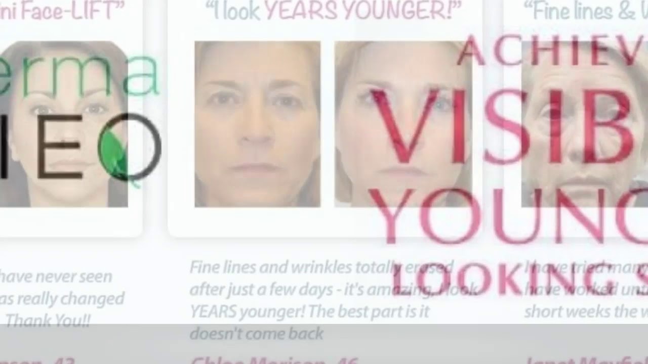 Derma Gieo Serum   The Free Trial Offer Is Back