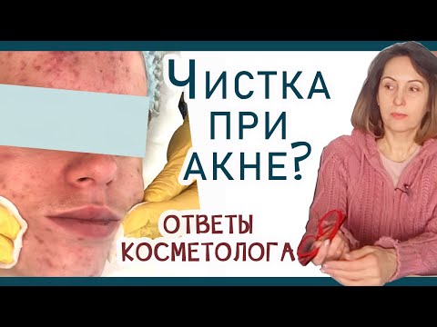 146| Чистка лица - добро или зло? Кому нужна? При акне. Куда идти? отвечаю на ваши вопросы