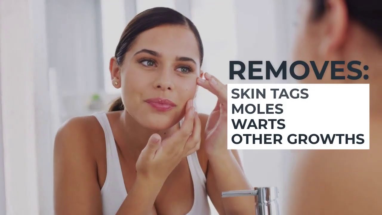 Remove Moles & Skin Tags with the SkinPro Extreme Tag & Mole Remover