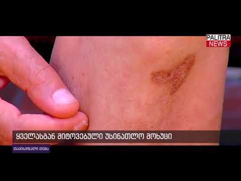 ყველასგან მიტოვებული უსინათლო მოხუცი - თავისუფალი თემა