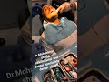 Dr Mohammad Shafiq Oral And Mixillofacial Surgen Dental Clinic Near TCS Office 03425311335 