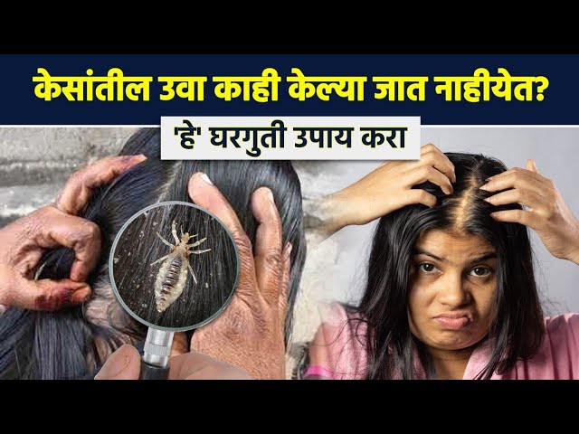 Yalangoch xotinlarning janjalli fotosuratlari Veb-kamerada etuk jinsiy aloqa