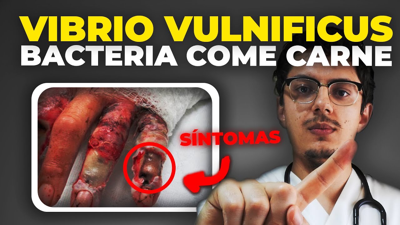 Qué es la BACTERIA COME CARNE ? Vibrio vulnificus | Síntomas y ...