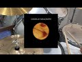   6  coldplay  yellow  drum cover