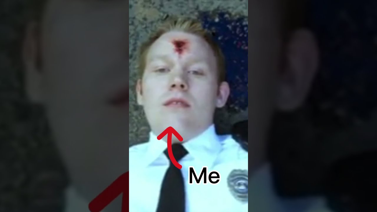 I Got Shot In The Head Shorts