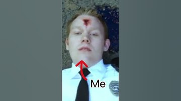 Thumbnail of I got shot in the head. #shorts