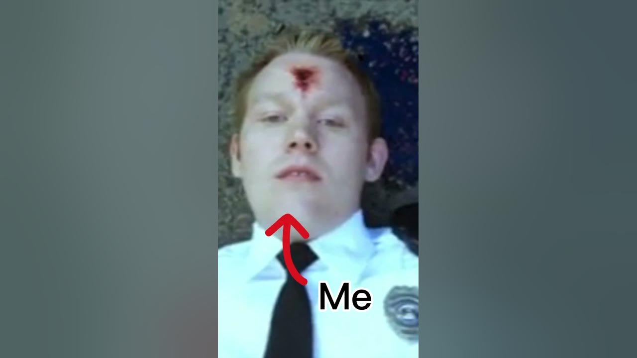 I got shot in the head. #shorts