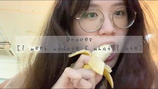 braces update [1 week of soft food hahahahaha] screenshot 5