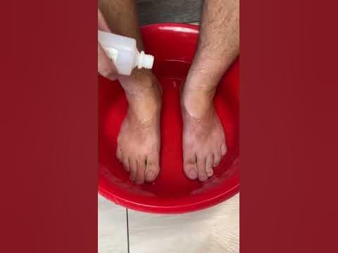 Как избавиться от трещин на пятках - YouTube