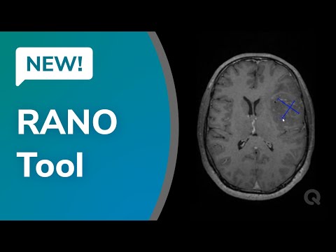 RANO Response Assessment In Neuro-Oncology - Short Demo - video from QMENTA