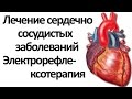 Лечение сердечно сосудистых заболеваний. Электрорефлексотерапия - Петренко Валентина Васильевна