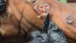 Jackson's jiggered hands - see long videos @ riseupsociety.net & ruskenya.org