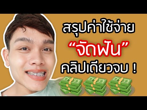 ค่าใช้จ่ายจัดฟัน สรุปค่าใช้จ่ายทั้งหมดในการจัดฟัน ดัดฟัน คลิปเดียวจบ จัดฟันครั้งแรก | ฟาอัลสุดติ่ง