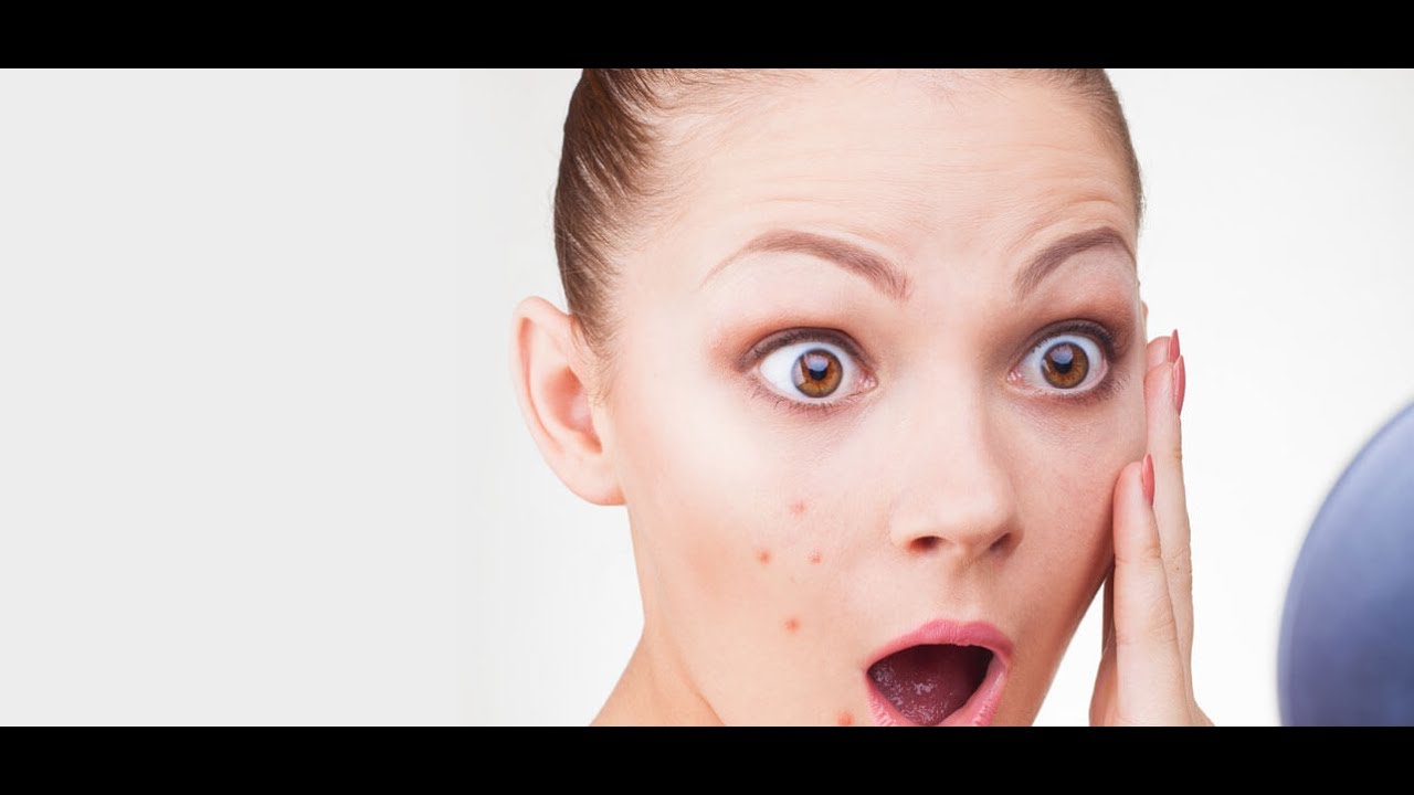 How To Quick Remove Pimples/Acne/Blemish "One Click" Easy Method... LightRoom YouTube