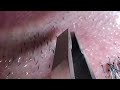 【毛抜き職人Classic】【Plucking facial hair】抜いたヒゲをキレイに並べる、目的はそれだけだ　毛抜き職人【2020. 1. 29公開作品の再録です】