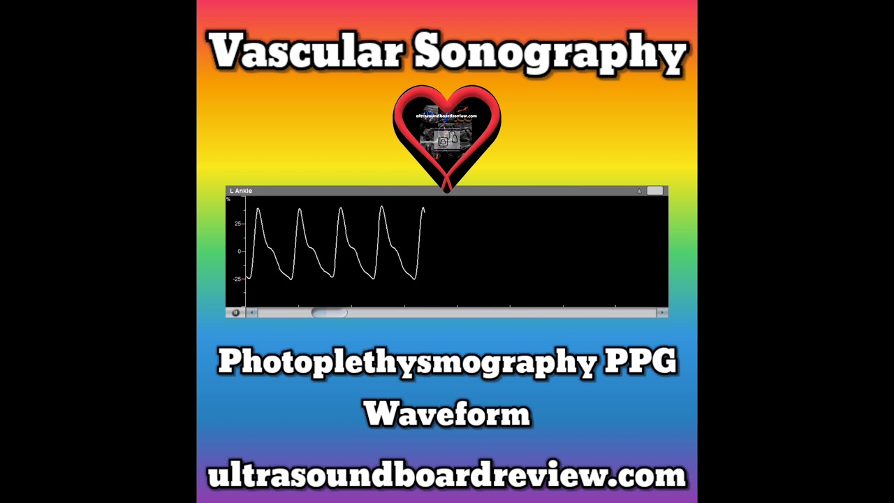 Photoplethysmography Waveforms