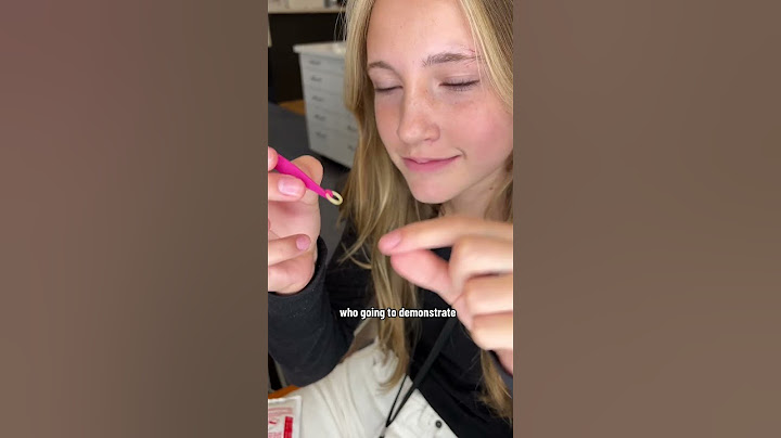 Elastic Placers for Braces to help you Put Your Rubber Bands on