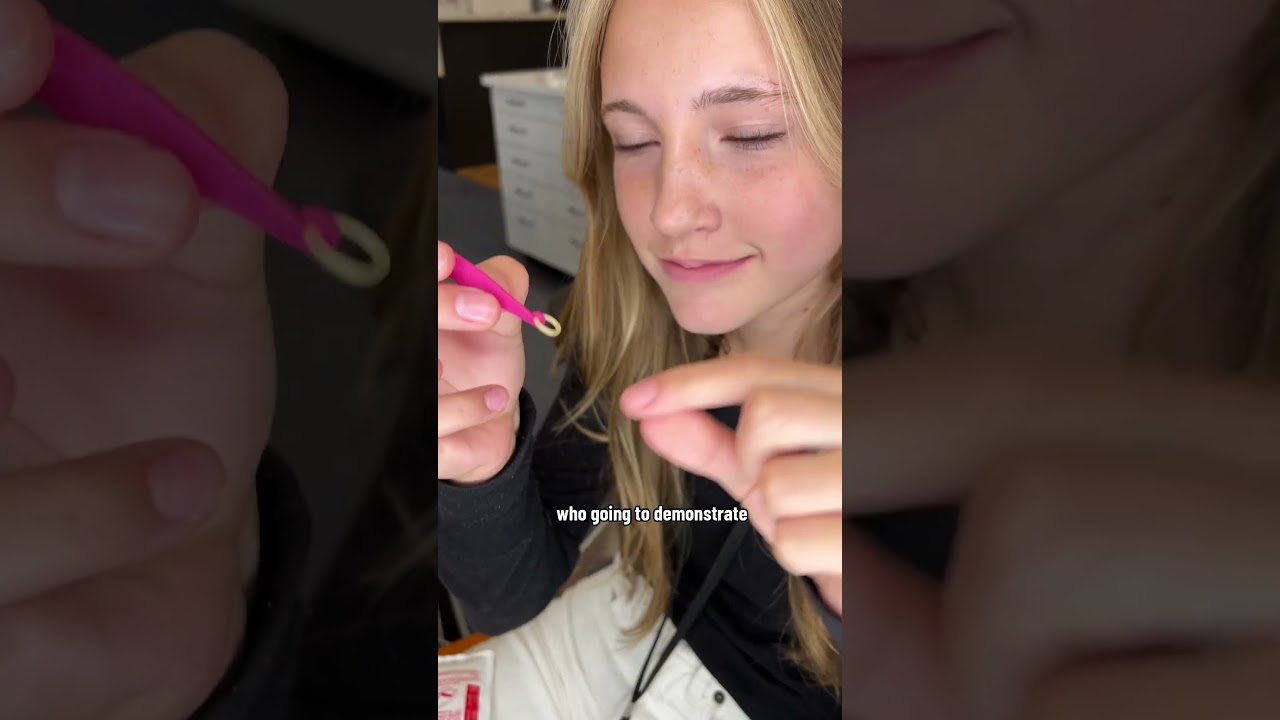 Эластичные накладки для брекетов, которые помогут вам надеть резинки