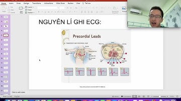 Đọc Điện tâm đồ(ECG): video 4: nguyên lý ghi ECG 1