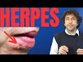 Herpes simplex (sulle labbra): rimedi, cause e contagio