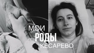 мои  первые роды | кесарево| ощущения и состояние после родов