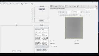 COQ de Image J. Software de análisis de imágenes DICOM