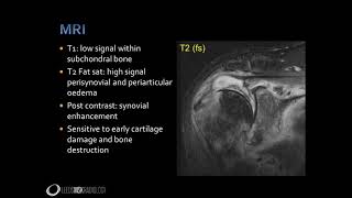 Imaging  findings of Septic arthritis, Tenosynovitis, Bursitis