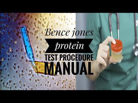 Bence jones protein test procedure manual - Requirements,procedure,interpretation