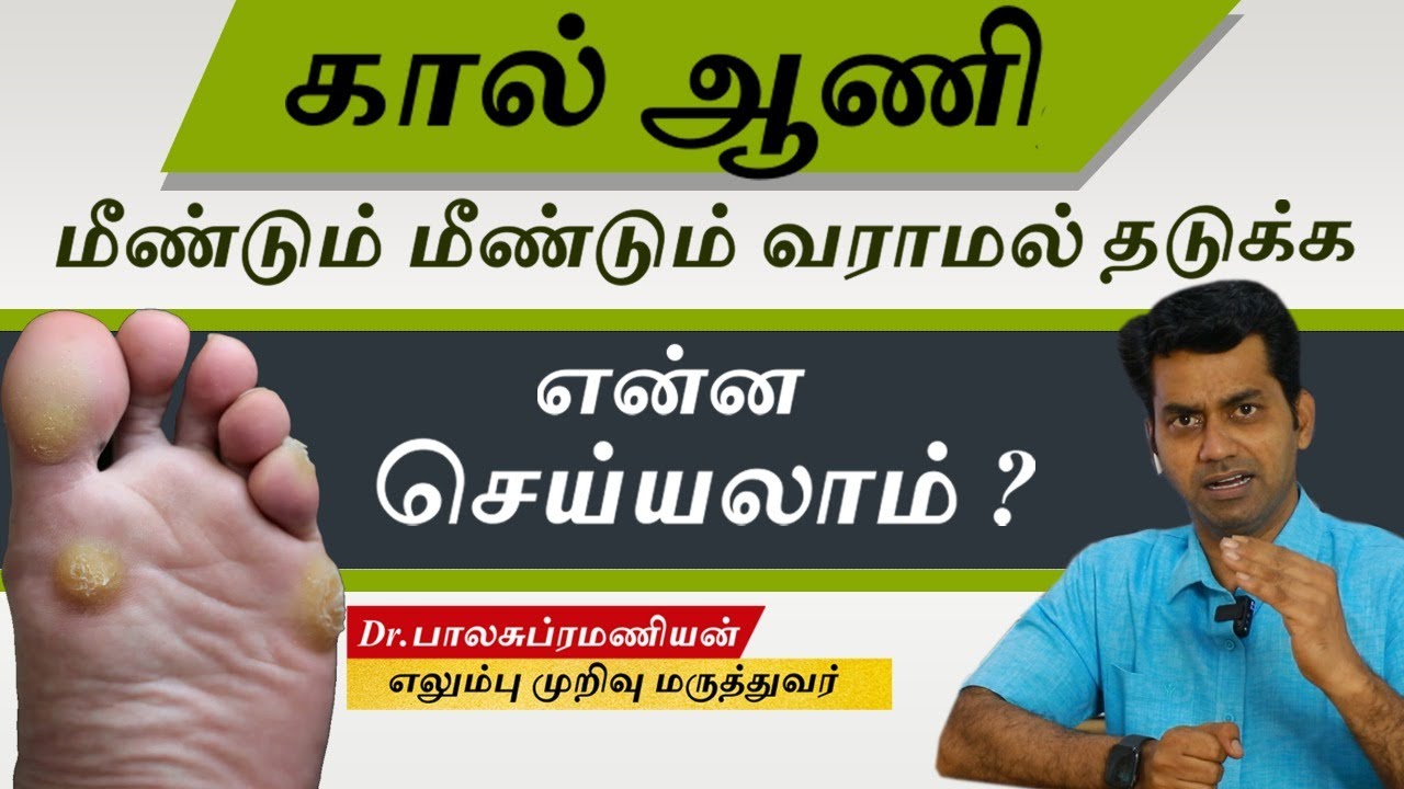 Foot Corns : கால் ஆணி மீண்டும் மீண்டும் வராமல் இருக்க என்ன செய்யலாம் | Dr Balasubramanian