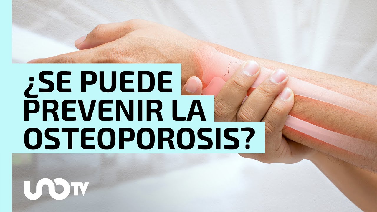 ¿Se puede prevenir la osteoporosis? IMSS emite YouTube