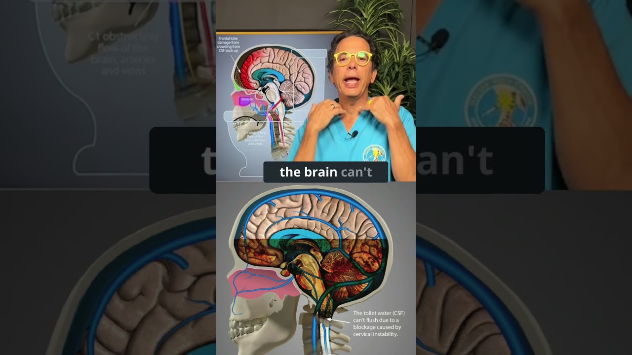 Brain fog and toxin buildup coming from the neck #brainfog #toxic #dementiaprevention #toilet