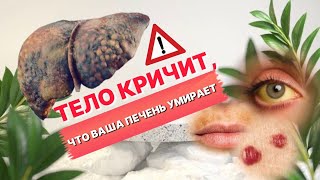 ❌ТЕЛО кричит, что ваша ПЕЧЕНЬ УМИРАЕТ!❌ 90% даже не знают об этом. 13 признаков, проверь себя.