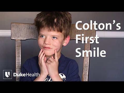 Boy with Moebius Syndrome Smiles for the First Time | Duke Health