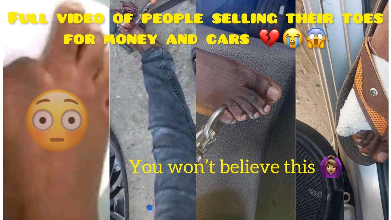 Full video of a man selling his toe Zimbabwe people are selling
