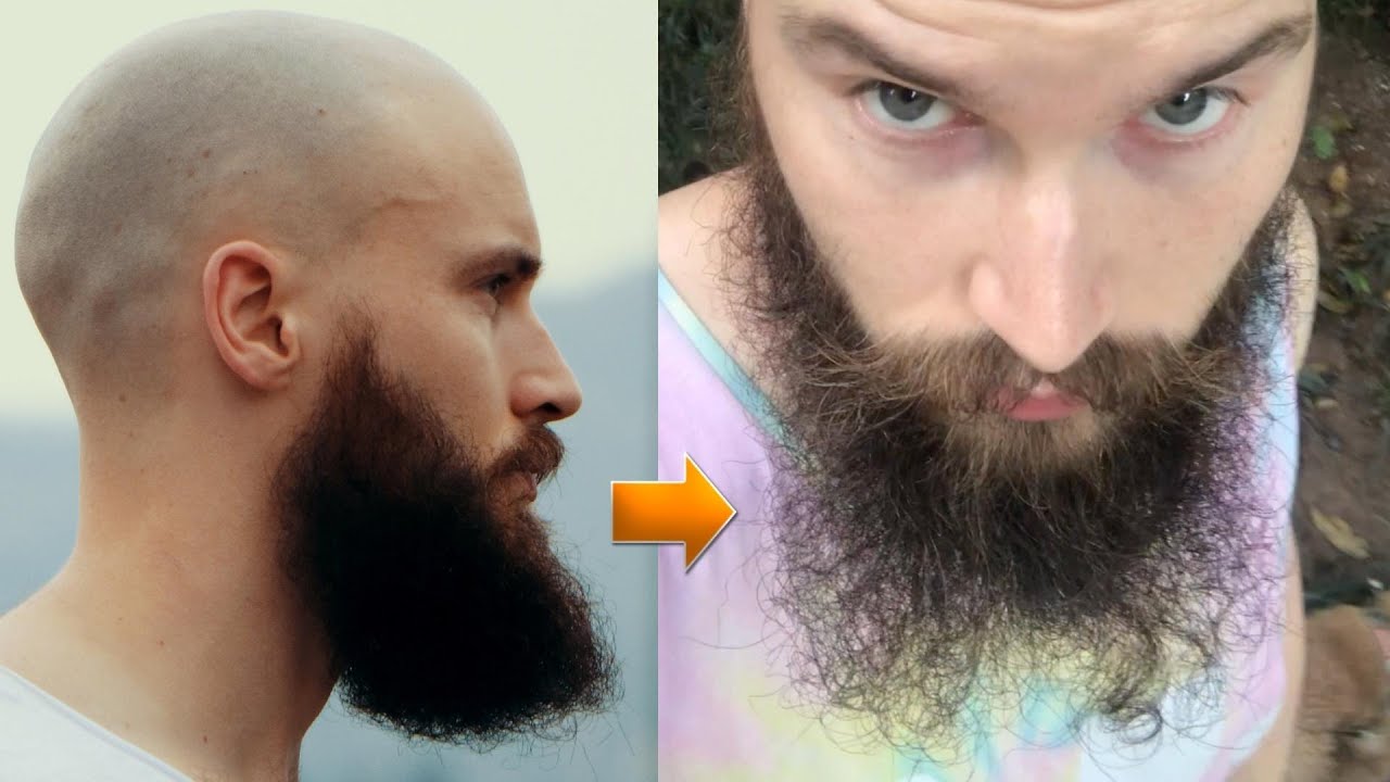 WHY Did My Beard DIE?