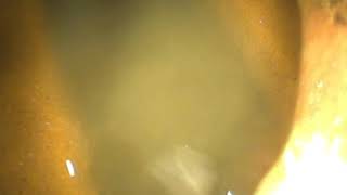 Lower Courtyard 105217