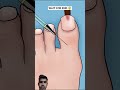 ASMR animation Foot piercing removal treatment #asmr #animation #shortsvideo #trending