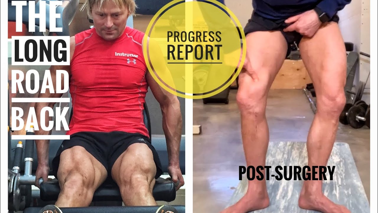 Cleared to Start Rehab by Surgeon: The Road to Full Recovery Can Now Begin