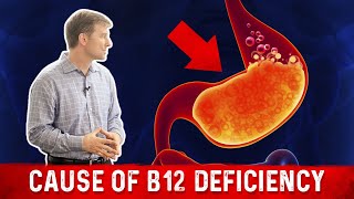 Vitamin B12 Deficiency: The most common Cause – Dr. Berg screenshot 4