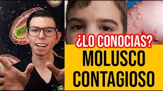 MOLUSCO QUE!! (Todo sobre MOLUSCO CONTAGIOSO) | DrPoloGuerrero