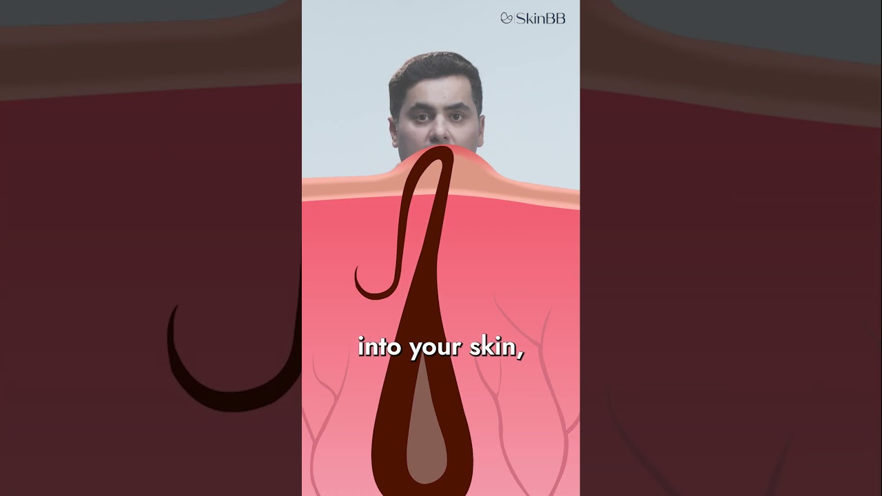 Pimples After Shaving? 🪒