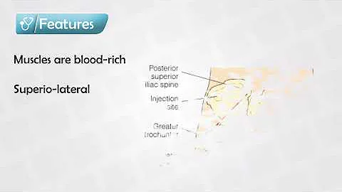 Proper Buttock (Glute) Injection - Location, Nerves, and Needles - DayDayNews