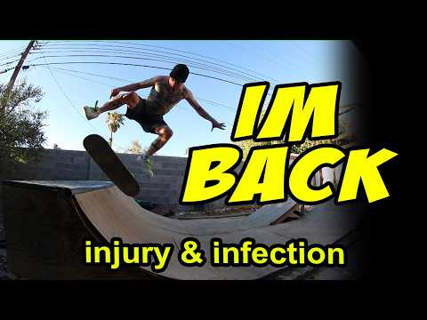 I landed THIS after 3 weeks of INJURY and PAIN kickflip 5-0 to tail