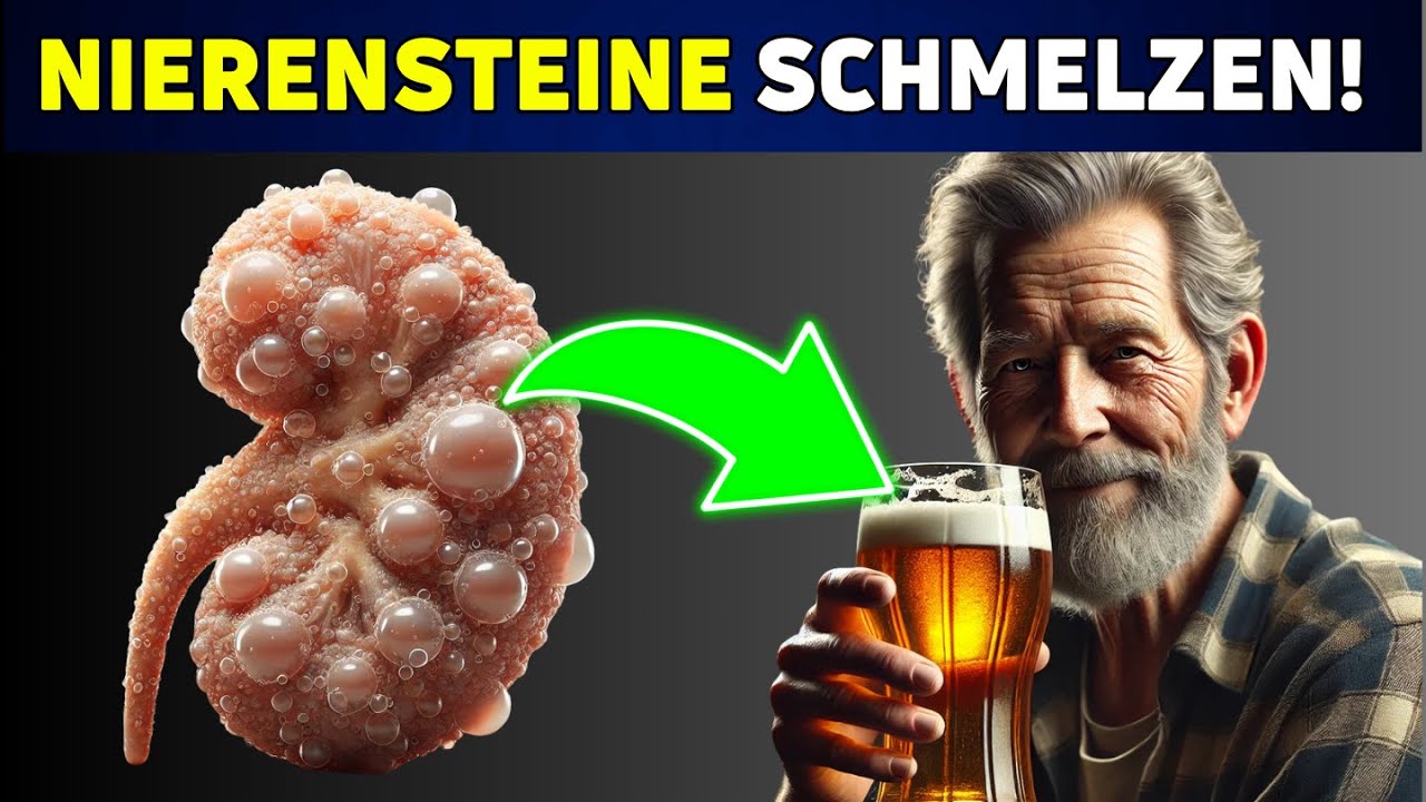 Die Top 10 Superfoods zur Sofortigen Vorbeugung von Nierensteinen