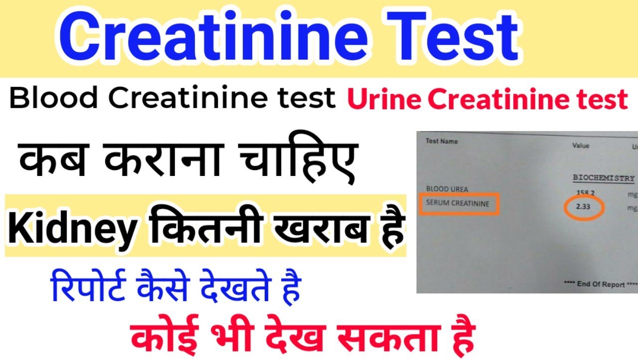 Creatinine Test Report Serum Urine Creatinine Test Creatinine Test Report Serum Urine Creatinine Test