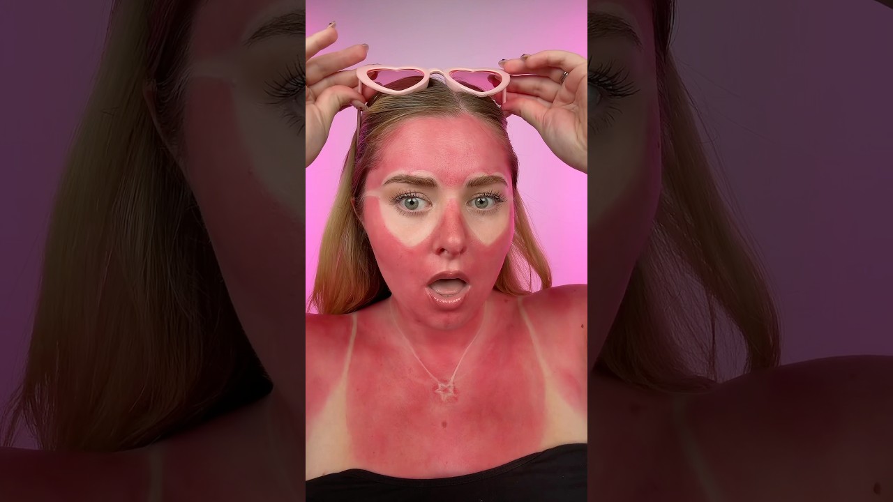 Paulas Sonnenbrand Look 🥵 kennt ihr den neuen Song von 