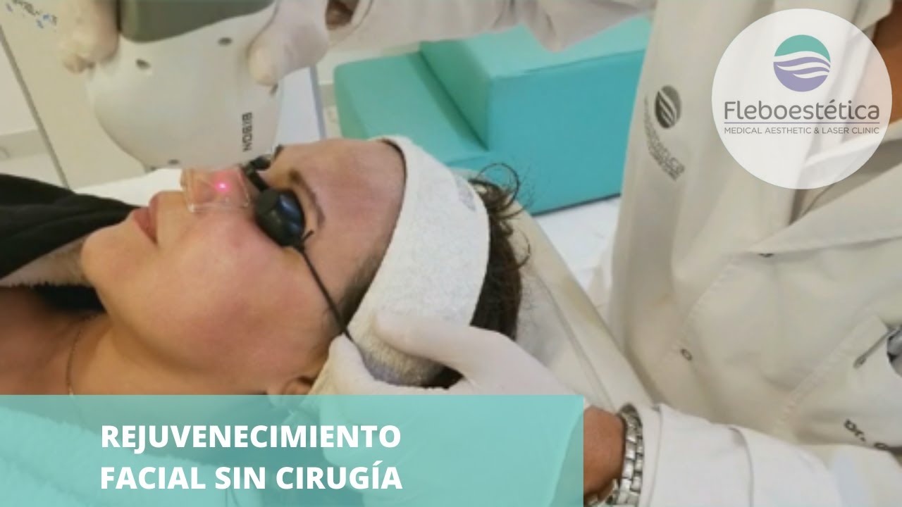 REJUVENECIMIENTO FACIAL SIN CIRUGÍA | FLEBOESTÉTICA