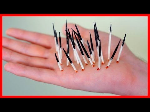 Video BỊ LÔNG NHÍM ĐÂM! - youtube
